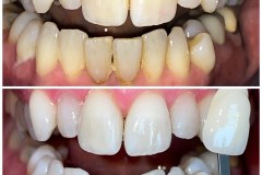 Did you know we offer Tooth Whitening? Prices start at just £350!